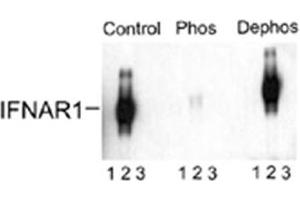 Western blot of immunoprecipitates from HEK 293 cells transfected with 1. (IFNAR1 Antikörper  (pSer535, pSer539))