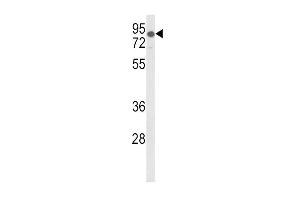 Western blot analysis of LDLR Antibody (Center) (ABIN652907 and ABIN2842585) in mouse lung tissue lysates (35 μg/lane). (LDLR Antikörper  (AA 391-419))