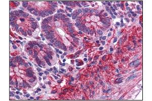 Human Small Intestine: Formalin-Fixed, Paraffin-Embedded (FFPE) (MTCH2 Antikörper  (N-Term))
