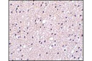 Immunohistochemistry of Presenilin1 in human brain tissue with this product at 2. (Presenilin 1 Antikörper  (C-Term))