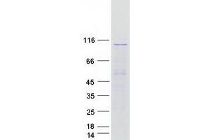 Validation with Western Blot (SEC63 Protein (Myc-DYKDDDDK Tag))