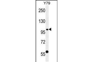 Western blot analysis in Y79 cell line lysates (35ug/lane). (PHF20 Antikörper  (N-Term))