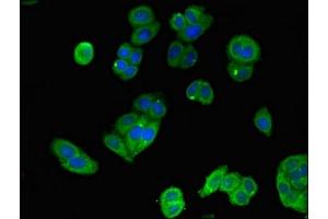 Immunofluorescent analysis of HepG2 cells using ABIN7150711 at dilution of 1:100 and Alexa Fluor 488-congugated AffiniPure Goat Anti-Rabbit IgG(H+L) (MAP2K4 Antikörper  (AA 259-398))