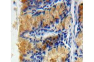 Used in DAB staining on fromalin fixed paraffin-embedded Bowels tissue (Caspase 6 Antikörper  (AA 194-293))