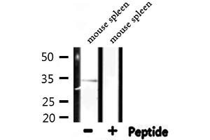 Western blot analysis of extracts from mouse spleen, using RPL5 Antibody. (RPL5 Antikörper  (C-Term))