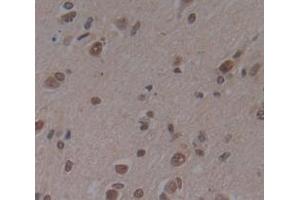 Used in DAB staining on fromalin fixed paraffin- embedded Kidney tissue (Deltex Homolog 1 Antikörper  (AA 290-535))