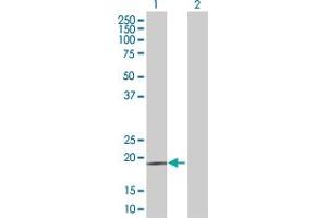 Western Blot analysis of CD53 expression in transfected 293T cell line by CD53 MaxPab polyclonal antibody. (CD53 Antikörper  (AA 1-219))