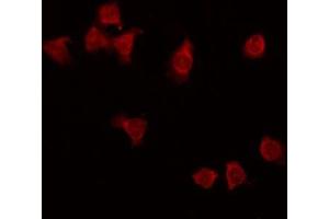 ABIN6275297 staining HT29 by IF/ICC. (NXPH3 Antikörper  (Internal Region))