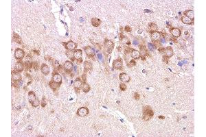 Formalin-fixed and paraffin embedded: rat brain tissue labeled with Anti-beta-Amyloid(1-42) Polyclonal Antibody , Unconjugated 1:200 followed by conjugation to the secondary antibody and DAB staining