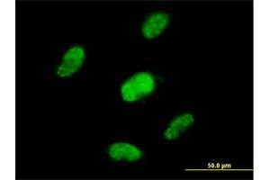 Immunofluorescence of purified MaxPab antibody to ZNF446 on HepG2 cell. (ZNF446 Antikörper  (AA 1-450))