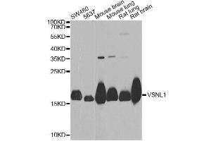 Western blot analysis of extracts of various cell lines, using VSNL1 Antibody. (VSNL1 Antikörper  (AA 1-191))