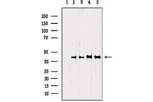 Western blot analysis of extracts from various samples, using NSDHL Antibody.