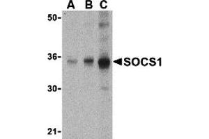 Western Blotting (WB) image for anti-Suppressor of Cytokine Signaling 1 (SOCS1) (N-Term) antibody (ABIN1031580) (SOCS1 Antikörper  (N-Term))
