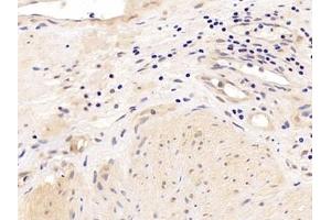 Detection of AR in Human Prostate Tissue using Polyclonal Antibody to Androgen Receptor (AR) (Androgen Receptor Antikörper  (AA 15-246))
