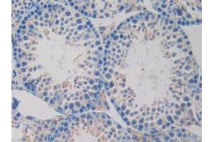 IHC-P analysis of Mouse Testis Tissue, with DAB staining. (OLR1 Antikörper  (AA 60-312))