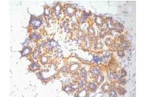 Immunohistochemistry (IHC) staining of Human Ovary tissue, diluted at 1:200. (beta Actin Antikörper)