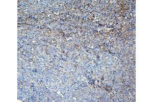 IHC analysis of LOR using anti-LOR antibody (ABIN6719582). (LOR Antikörper  (AA 1-312))