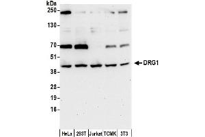 anti-Developmentally Regulated GTP Binding Protein 1 (DRG1) (AA 200-250) antibody