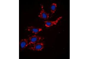Immunofluorescence (IF) image for anti-Collagen, Type XVIII, alpha 1 (COL18A1) (Center) antibody (ABIN2982659) (COL18A1 Antikörper  (Center))