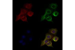 ABIN6263465 and ABIN6279559 staining Hela cells by IF/ICC.