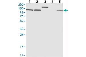 Western blot analysis of Lane 1: RT-4, Lane 2: U-251 MG, Lane 3: Human Plasma, Lane 4: Liver, Lane 5: Tonsil with EFTUD2 polyclonal antibody  at 1:250-1:500 dilution. (EFTUD2 Antikörper)