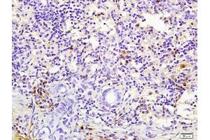 Formalin-fixed and paraffin embedded rabbit pancreas labeled with Rabbit Anti pro-caspase-3 Polyclonal Antibody, Unconjugated (ABIN747728) at 1:200 followed by conjugation to the secondary antibody and DAB staining (Caspase 3 Antikörper  (AA 11-120))