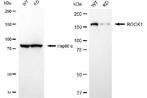 Western blotting analysis using ROCK1 antibody (ABIN7800203). (Rekombinanter ROCK1 Antikörper)