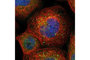 Immunofluorescent staining of human cell line A-431 shows localization to vesicles.