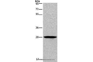 Western blot analysis of Human bladder carcinoma tissue, using KLRF1 Polyclonal Antibody at dilution of 1:300 (KLRF1 Antikörper)