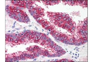 Image no. 1 for anti-Toll-Like Receptor 5 (TLR5) (Center) antibody (ABIN303300) (TLR5 Antikörper  (Center))