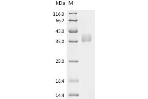 (Tris-Glycine gel) Discontinuous SDS-PAGE (reduced) with 5 % enrichment gel and 15 % separation gel.