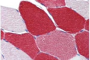 Immunohistochemistry (Formalin-fixed Paraffin-embedded Sections) (IHC (fp)) image for anti-Myosin Light Chain 6, Alkali, Smooth Muscle and Non Muscle (MYL6) (AA 72-121) antibody (ABIN6744460)