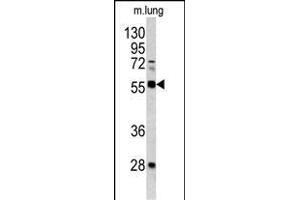 Western blot analysis of FLI1 antibody (Center) (ABIN390409 and ABIN2840798) in mouse lung tissue lysates(35 μg/lane). (FLI1 Antikörper  (AA 299-328))