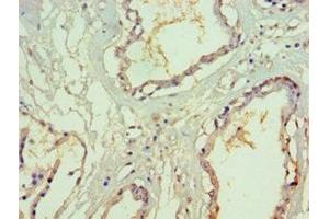 Immunohistochemistry of paraffin-embedded human prostate tissue using ABIN7170623 at dilution of 1:100 (SF3B3 Antikörper  (AA 948-1217))