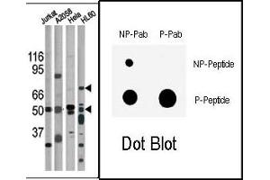 Image no. 1 for anti-Checkpoint Kinase 1 (CHEK1) (pSer317) antibody (ABIN358109) (CHEK1 Antikörper  (pSer317))