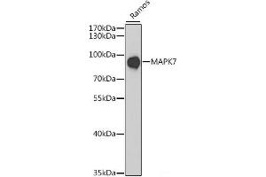 Western blot analysis of extracts of Ramos cells using MAPK7 Polyclonal Antibody at dilution of 1:1000. (MAPK7 Antikörper)