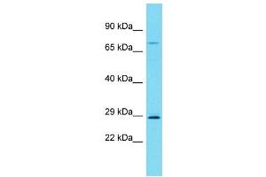 Host:  Rabbit  Target Name:  Rrp7a  Sample Type:  Rat Spleen lysates  Antibody Dilution:  1. (RRP7A Antikörper  (C-Term))