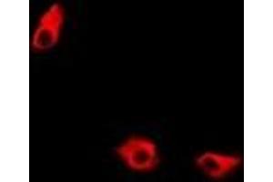 Immunofluorescent analysis of KIF2B staining in A549 cells. (KIF2B Antikörper)