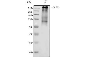 Western blot analysis of Collagen VII/COL7A1 using anti-Collagen VII/COL7A1 antibody (ABIN7601052).