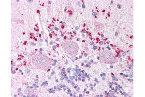 Immunohistochemistry (IHC) image for anti-Wingless-Type MMTV Integration Site Family, Member 7A (WNT7A) (Internal Region) antibody (ABIN1049482)