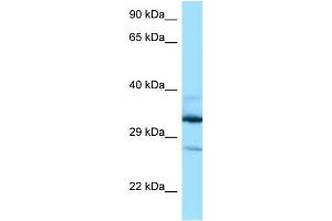WB Suggested Anti-DOHH Antibody Titration: 1. (DOHH Antikörper  (N-Term))