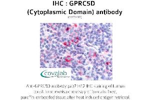 Image no. 1 for anti-G Protein-Coupled Receptor, Family C, Group 5, Member D (GPRC5D) (1st Cytoplasmic Domain) antibody (ABIN1735222) (GPRC5D Antikörper  (1st Cytoplasmic Domain))