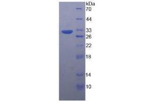 Image no. 1 for Tubulin, beta (TUBB) (AA 170-419) (Active) protein (His tag) (ABIN6239912) (TUBB Protein (AA 170-419) (His tag))