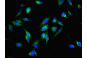 Immunofluorescent analysis of Hela cells using ABIN7159861 at dilution of 1:100 and Alexa Fluor 488-congugated AffiniPure Goat Anti-Rabbit IgG(H+L) (Fission 1 Antikörper  (AA 1-122))