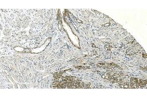 IHC analysis of H Cadherin/CDH13 using anti-H Cadherin/CDH13 antibody (ABIN7600095). (Cadherin 13 Antikörper  (AA 149-692))