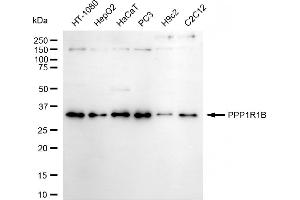 Western blotting analysis using PPP1R1B antibody (ABIN7800018).