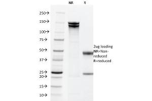 SDS-PAGE Analysis Purified EpCAM Mouse Monoclonal Antibody (PAN-EpCAM). (EpCAM Antikörper)