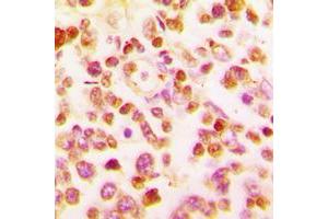Immunohistochemical analysis of BCL6 staining in human tonsil formalin fixed paraffin embedded tissue section. (BCL6 Antikörper  (C-Term))