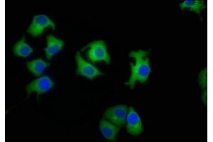 Immunofluorescence staining of A549 cells with ABIN7157890 at 1:50, counter-stained with DAPI. (LAMb4 Antikörper  (AA 1513-1761))