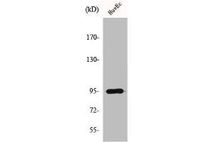 Western Blot analysis of A549 cells using HURP Polyclonal Antibody (DLGAP5 Antikörper  (C-Term))